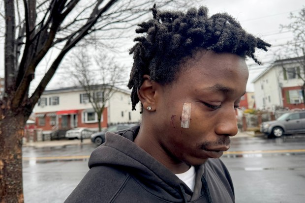 Markel Washington, 24, at the scene where he was pistol-whipped and his best friend Tyreek Moore was shot to death. (Rebecca White / New York Daily News)